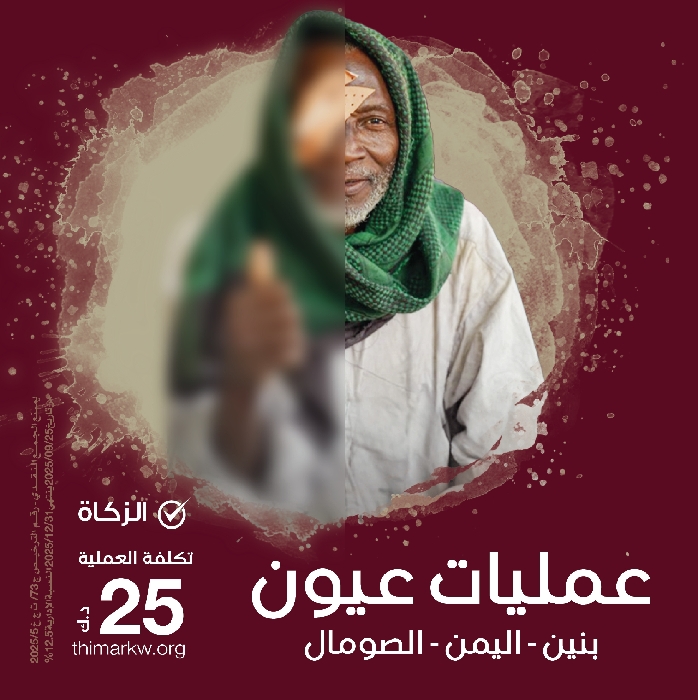 صورة عمليات عيون - عدة دول 