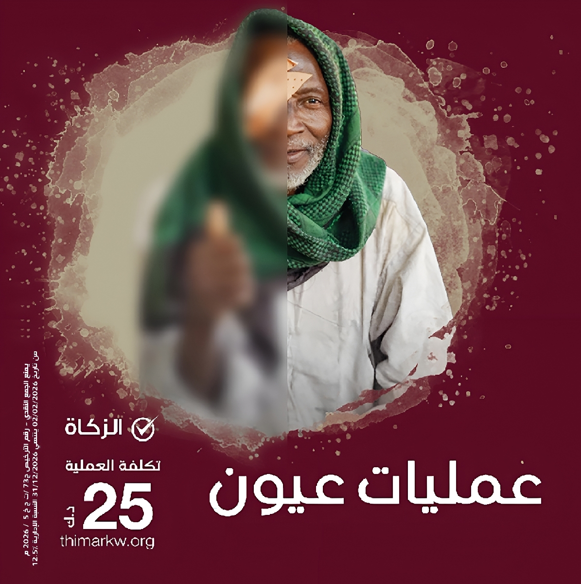 صورة عمليات العيون